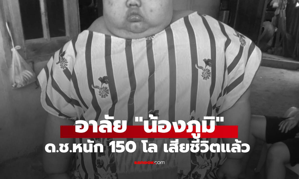 หมอสุดยื้อ "น้องภูมิ" เด็กชายวัย 11 ชอบกินดิน น้ำหนักกว่า 150 กก. เสียชีวิตแล้ว