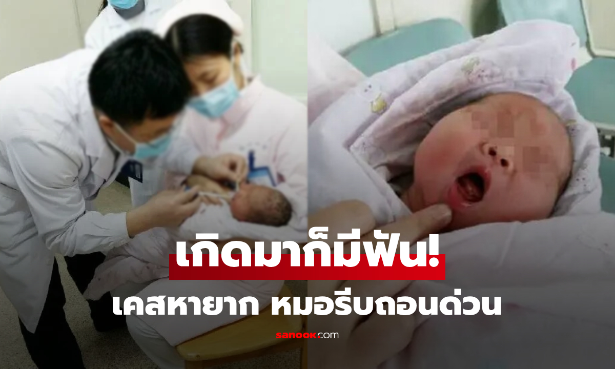 ไม่ใช่ฟันน้ำนม! ทารกคลอดมา "มีฟันในปาก" แพทย์รีบถอนออกด่วน เผยอันตรายอย่างไร?