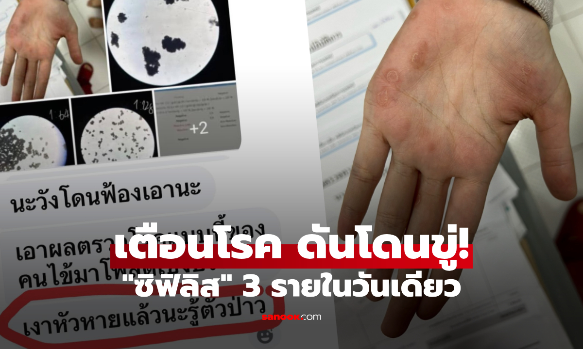 โพสต์รูปเตือน "ซิฟิลิส" วันเดียว 3 ราย นักเทคนิคการแพทย์เจอดราม่า ถึงขั้นมีคนขู่เงาหัวหาย?!