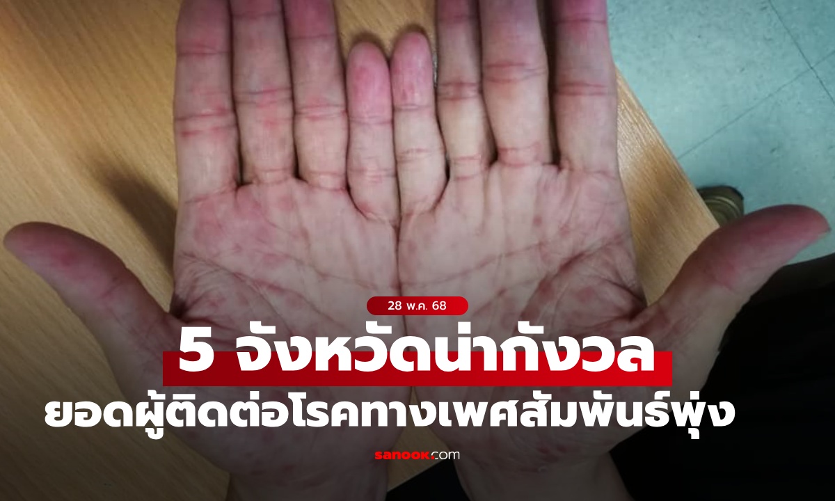 กองโรคเอดส์ เปิดรายชื่อ 5 จังหวัดน่ากังวล โรคติดต่อทางเพศสัมพันธ์ ยอดผู้ป่วยพุ่ง!