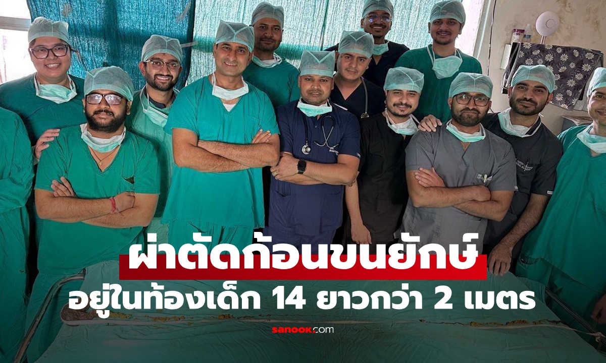 เด็กหญิงป่วยโรคราพันเซล มีก้อนผมยักษ์ในท้อง หมอตะลึงยาวกว่า 2 เมตร ทุบสถิติโลก