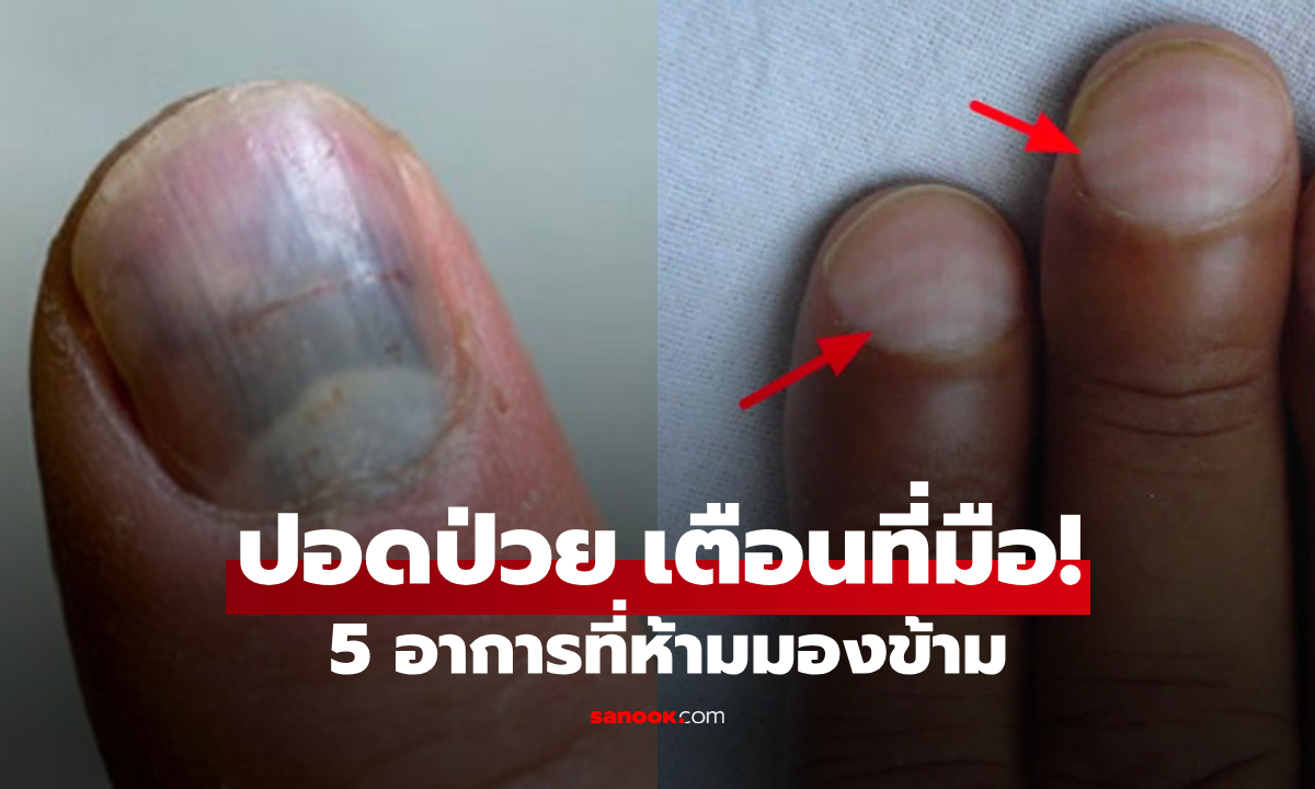 รู้ให้ทันโรคในตัว! เช็ก 5 เบาะแสบนมือ บ่งชี้ "ปอดป่วย" ไม่ใช่แค่นิ้วเขียว-มือชา-เจ็บแปลบ
