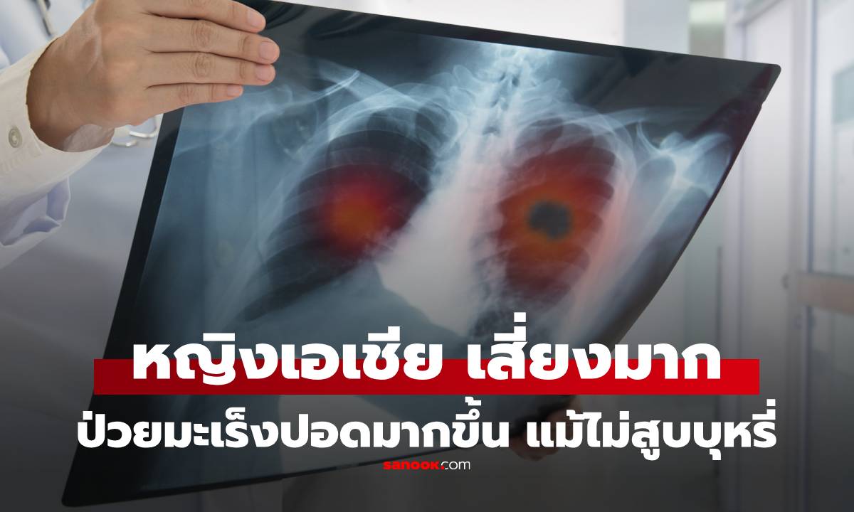 เตือน "มะเร็งปอด" หมอมานพ ยกเคส เอ๋ พรทิพย์ ชี้ "หญิงเอเชียที่ไม่สูบบุหรี่" เสี่ยงหนัก!