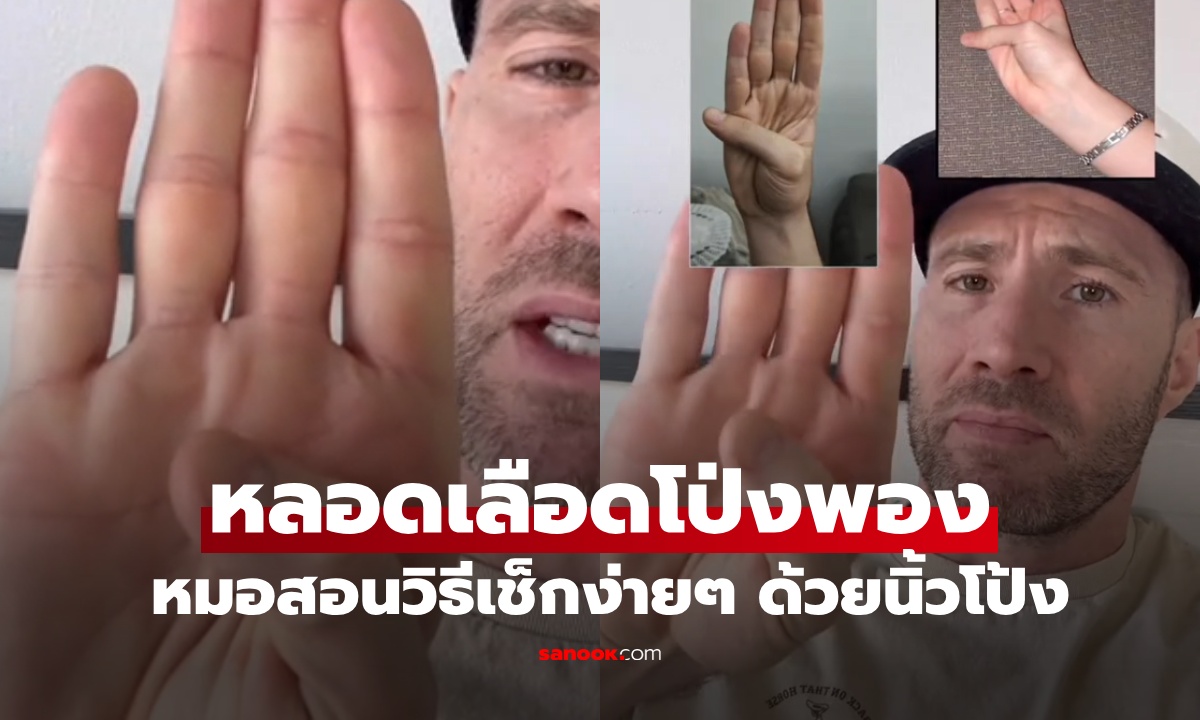 หมอฉุกเฉินสอนเช็กความเสี่ยง "หลอดเลือดโป่งพอง" วิธีง่ายๆ แค่ทำนิ้วโป้งแบบนี้!