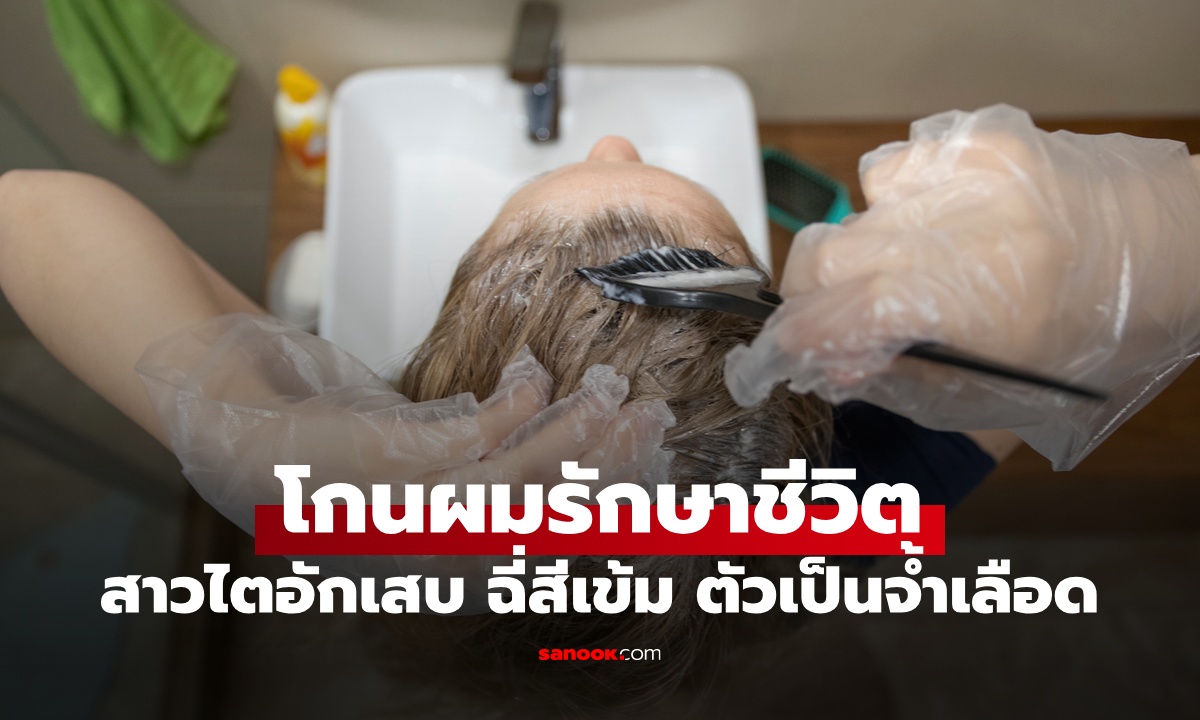 "ย้อมผม" จำจนตาย! สาวไตอักเสบ ฉี่สีน้ำตาลเข้ม-ตัวเป็นจ้ำเลือด ต้องโกนหัวรักษาชีวิต