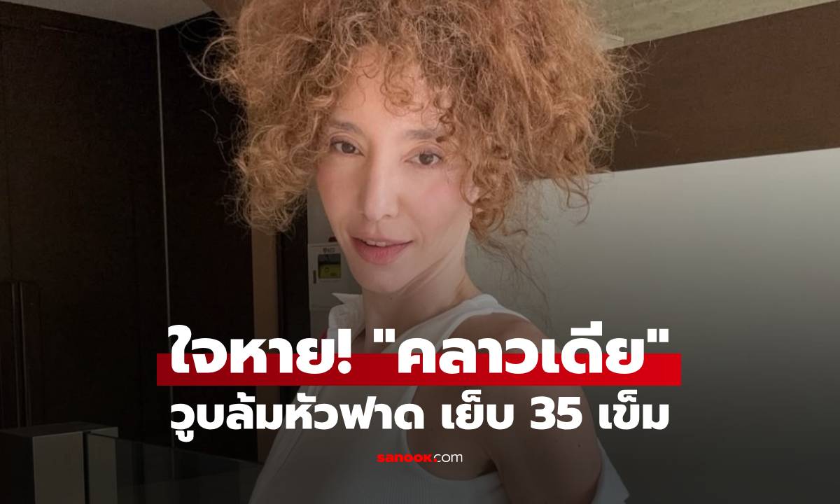 "คลาวเดีย" วูบล้มหัวฟาด หน้าผากแตก จมูกกระดูกร้าว เย็บ 35 เข็ม