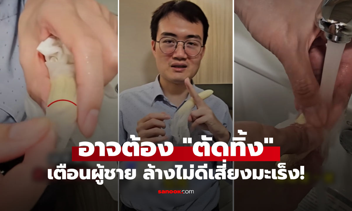 ขนลุก! ผู้ชายไม่ล้างส่วนนี้ เป็นมะเร็งองคชาต "ต้องตัดทิ้ง" หมอเตือน อย่าใช้เจลอาบน้ำล้าง