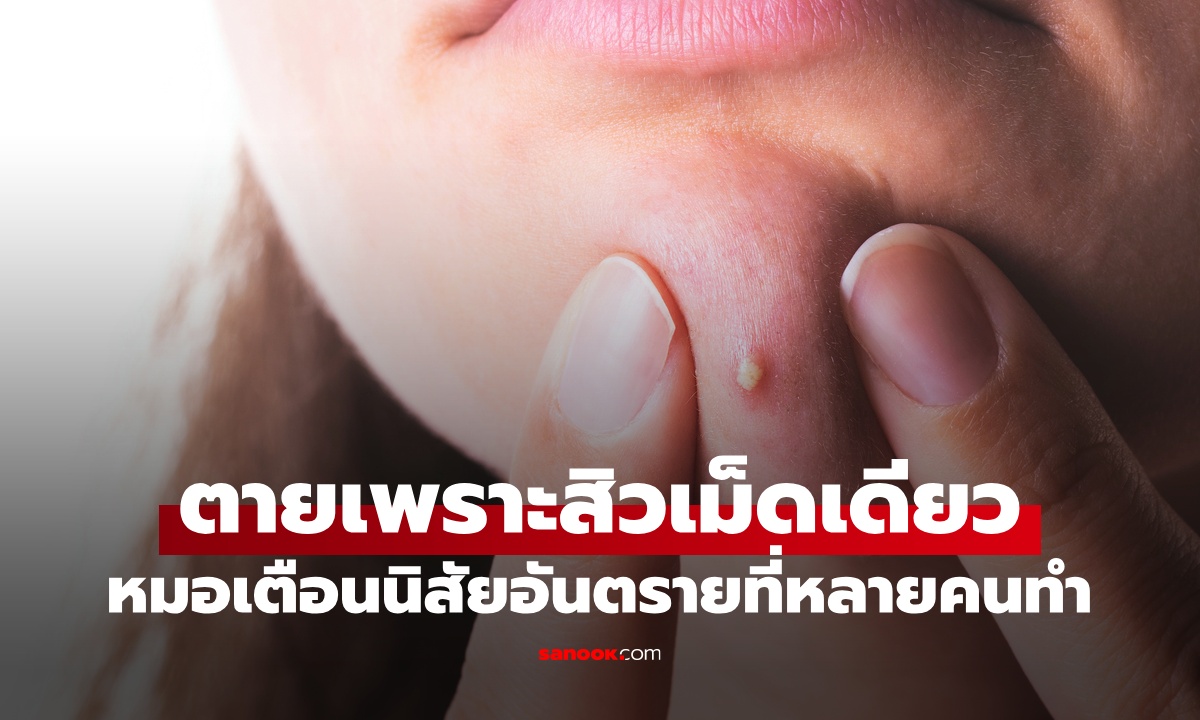 อ่านไม่ผิด เด็กสาววัย 15 ตายเพราะ "สิวเม็ดเดียว" หมอชี้นิสัยอันตรายที่หลายคนยังทำ