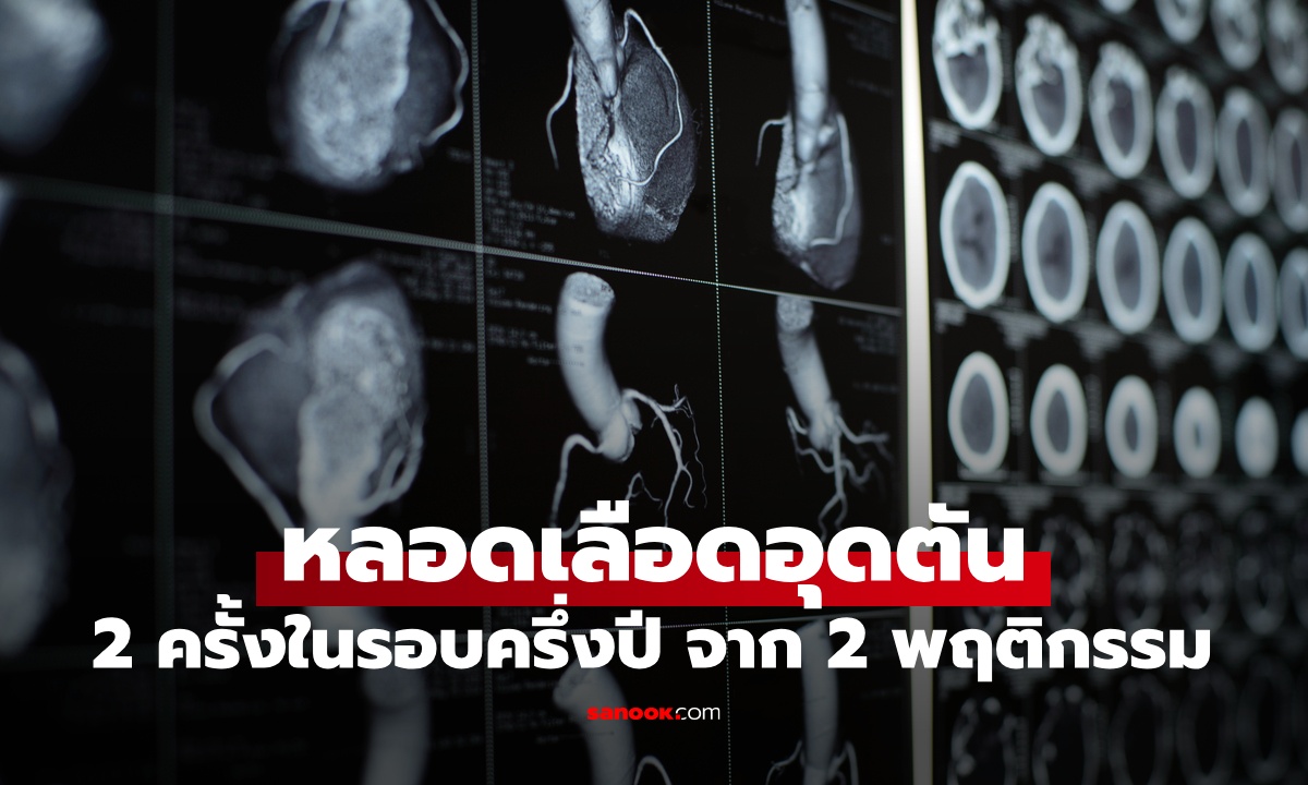 หมอก็เตือนแล้ว คนไข้หลอดเลือดหัวใจอุดตัน ไม่หยุด 2 พฤติกรรม ผ่านไปครึ่งปีรู้เรื่อง!