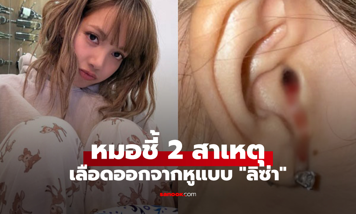 แพทย์ถอดบทเรียน "ลิซ่า" เลือดไหลออกจากหู เตือน 2 สาเหตุหลัก แนะวิธีรับมือเมื่อมีอาการ!