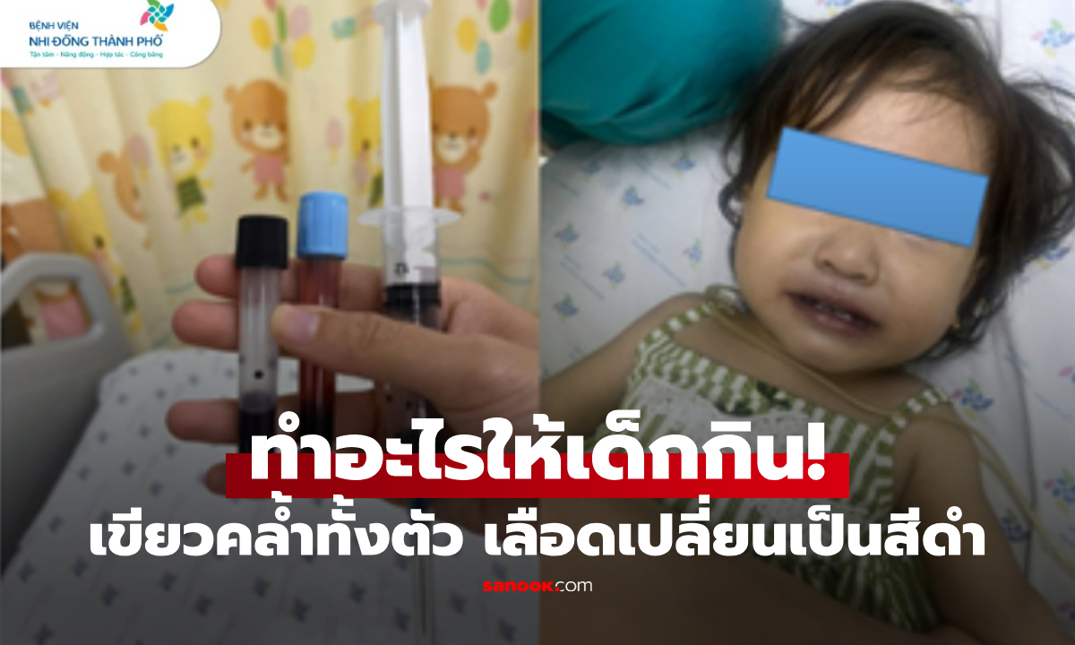 ช็อกทั้งบ้าน! ลูกสาว 1 ขวบ ตัวเขียว-เลือดดำ หลังกิน "ซุป" รู้วิธีปรุงหมอส่ายหัว