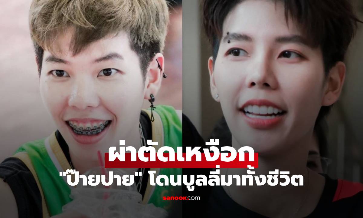 "ป๊ายปาย" โดนบูลลี่มาทั้งชีวิต ผ่าตัดเหงือก "นุ๊ก" อวยยศ ทำสวยเตรียมลงมิสแกรนด์