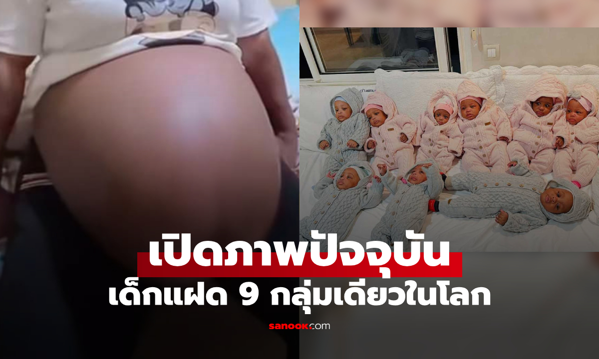 จำได้ไหม? ทารกแฝด 9 "กลุ่มเดียวของโลก" เปิดภาพปัจจุบัน ชาย 4 หญิง 5 โตแค่ไหนแล้ว!