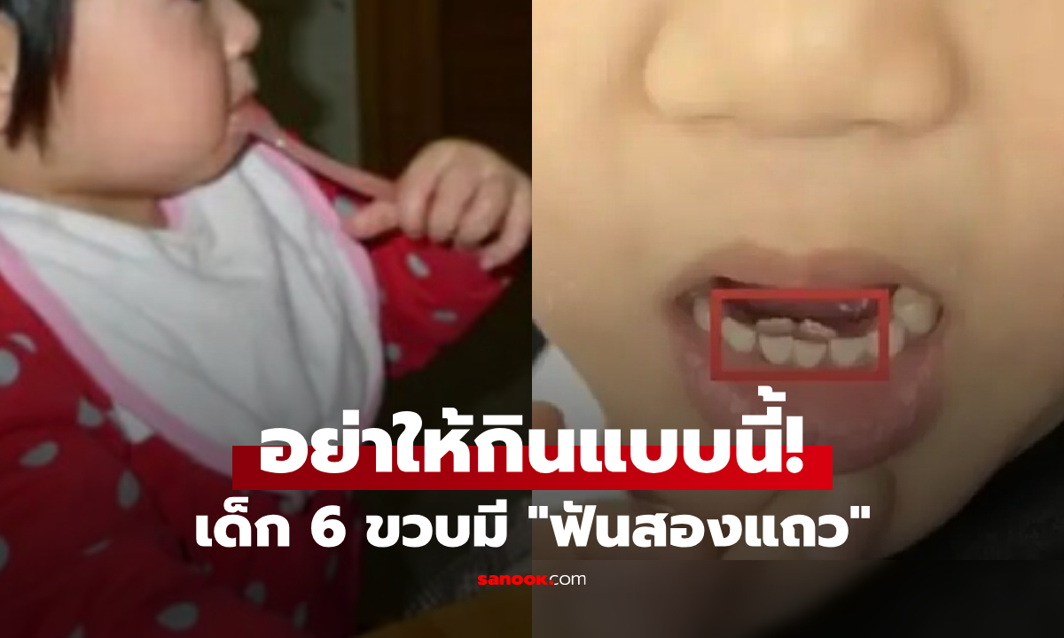 หลาน 6 ขวบมี "ฟันสองชั้น" แพทย์ยังส่ายหน้า หลังรู้วิธีเลี้ยงแบบ "กลัวสำลัก" ของคุณย่า!