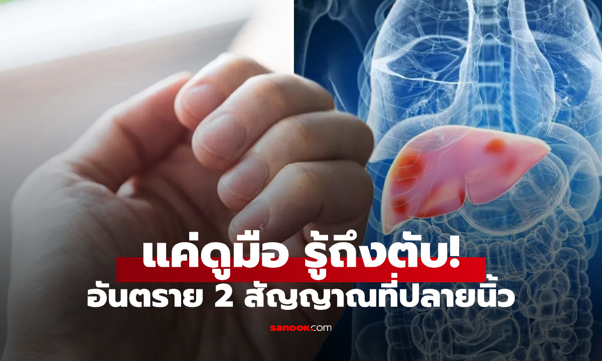 แค่ดูมือ บอกถึงตับ!  หากเห็นสัญญาณ 2 ประการนี้บนเล็บ ควรไปพบแพทย์ทันที