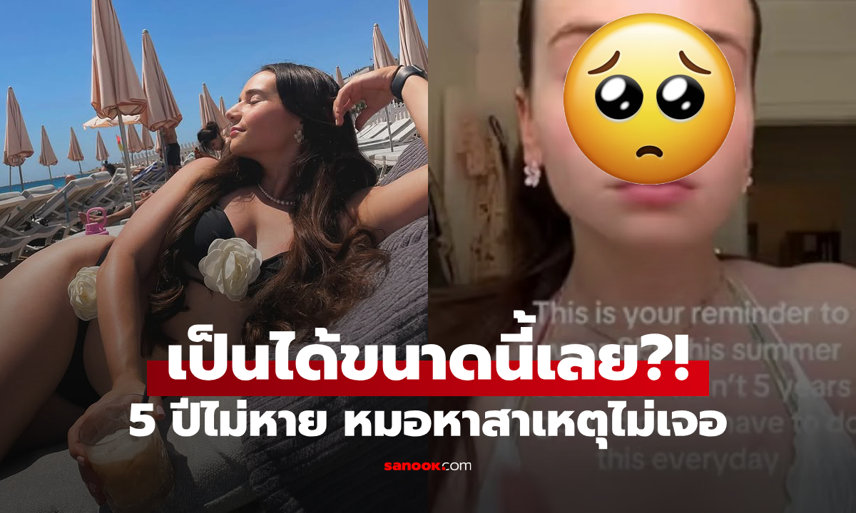 แดดเผาได้ขนาดนี้?! สาวเครียด "จมูกแดง" คล้ายตัวตลก 5 ปียังไม่หาย หมอก็ไม่รู้จะทำยังไง