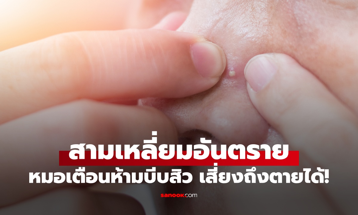 ตำแหน่ง "สามเหลี่ยมอันตราย" บนใบหน้า ห้ามบีบสิวเด็ดขาด เสี่ยงถึงตายได้!