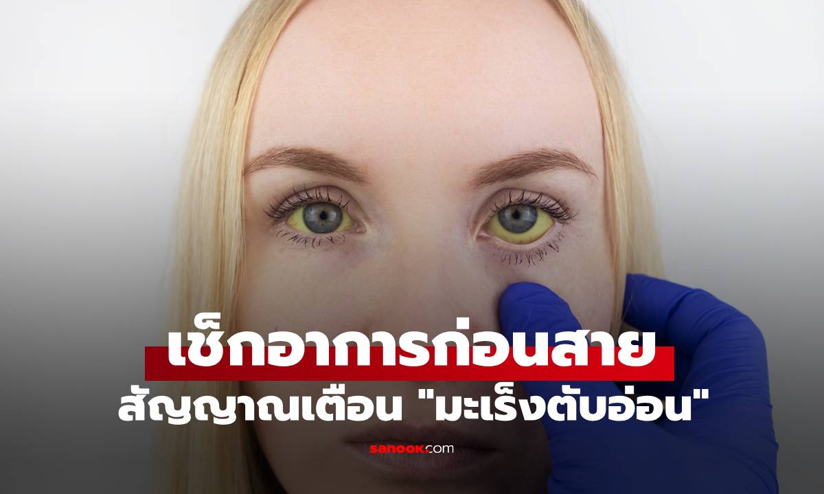 หมอเมืองนอกเผย สัญญาณที่มองเห็นได้ของ "มะเร็งตับอ่อน" แต่หลายคนมักมองข้าม