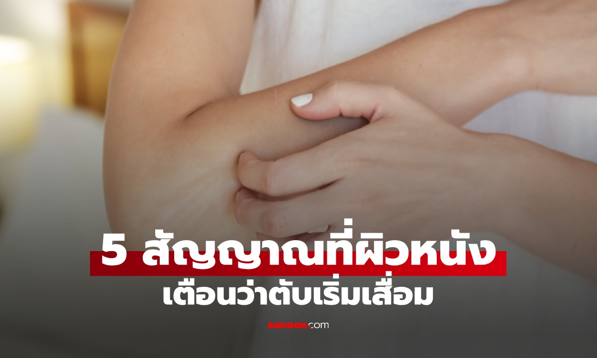 5 สัญญาณบนผิวหนัง เตือนว่า "ตับ" เริ่มเสื่อม ตรงแค่ข้อเดียวก็อย่าชะล่าใจ!