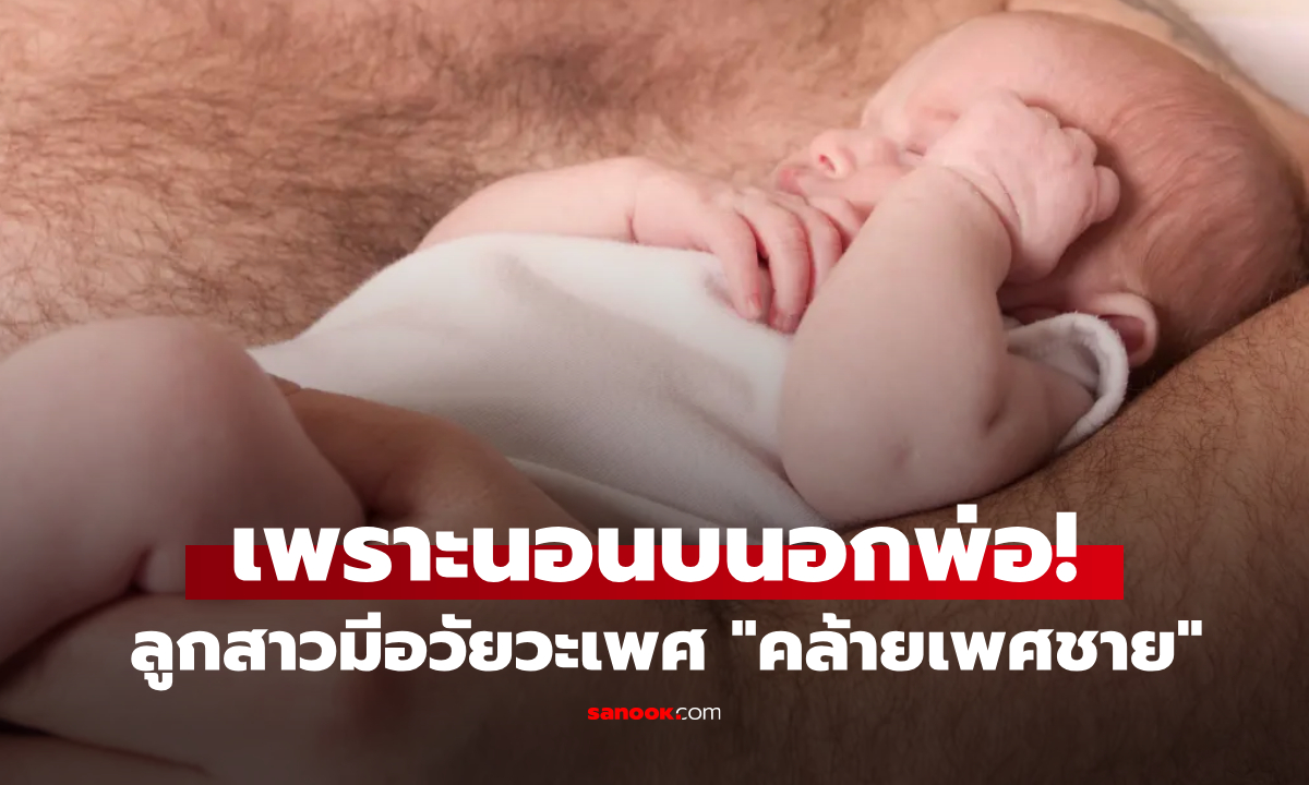 ทารกหญิงมีอวัยวะเพศ "คล้ายเพศชาย" เพราะนอนทับอกพ่อ หมอเตือนอาจเกิดจากสิ่งนี้!