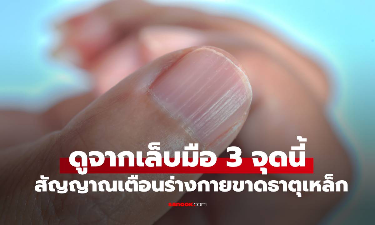 รีบเช็กด่วน! คนที่ขาดธาตุเหล็ก ดูจาก "เล็บมือ" ได้เลย 3 จุดนี้ แต่คนชอบมองข้าม