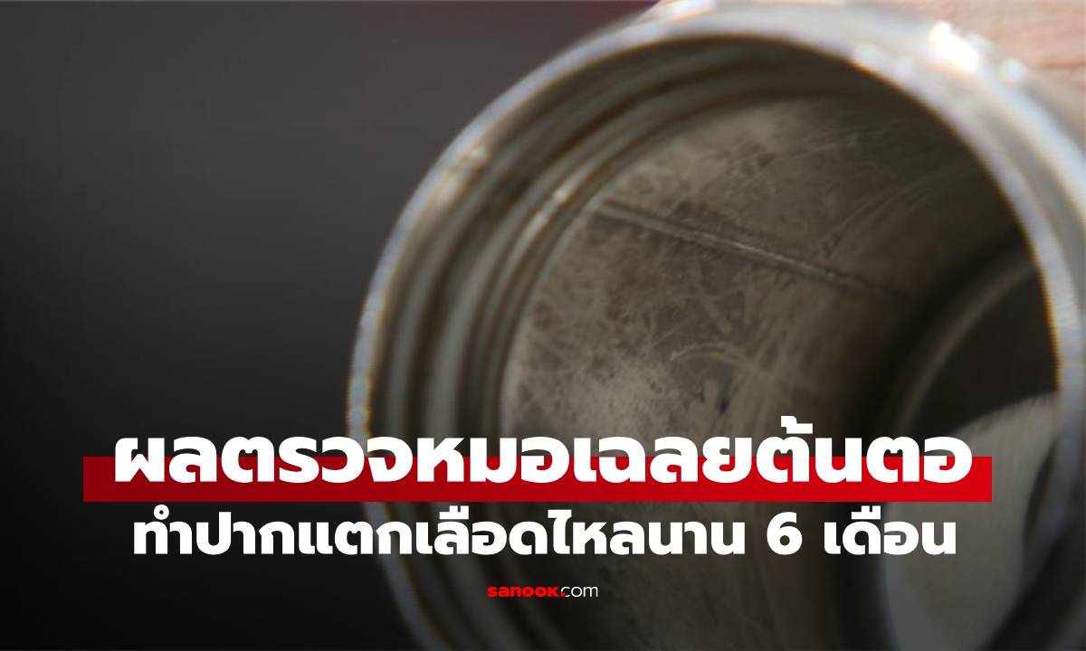สาววัย 26 ปากแตกเลือดไหลนาน 6 เดือน ผลตรวจหมอเฉลย สิ่งที่ใช้ทุกวันกลายเป็นยาพิษ