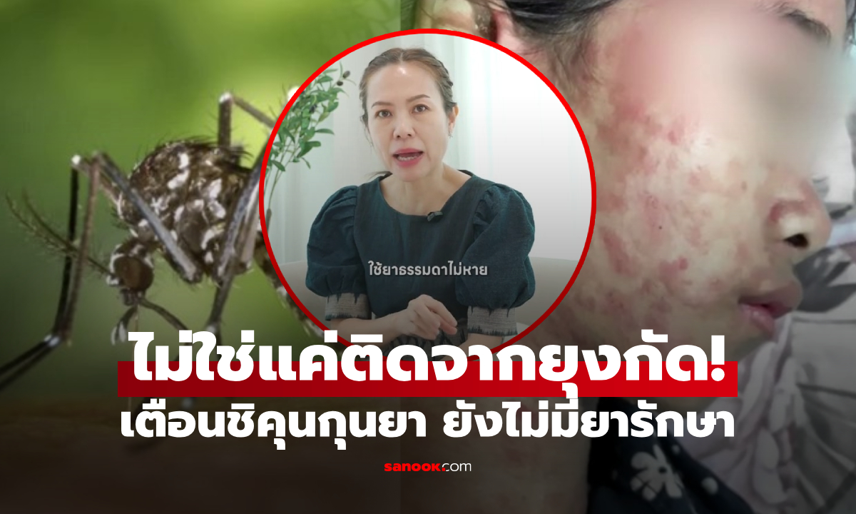ไม่ใช่แค่ยุงกัด! หมอแม่เตือน “โรคชิคุนกุนยา” ที่แปลว่าปวดจนตัวงอ ติดต่อทางใดได้บ้าง?