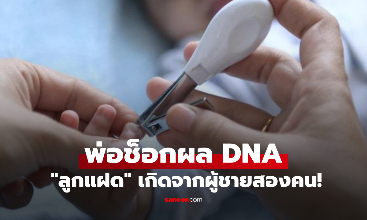 "ลูกแฝด" ยิ่งโตยิ่งต่างกัน พ่อแอบตรวจ DNA เจอความจริงสุดช็อก เกิดจากผู้ชายสองคน!