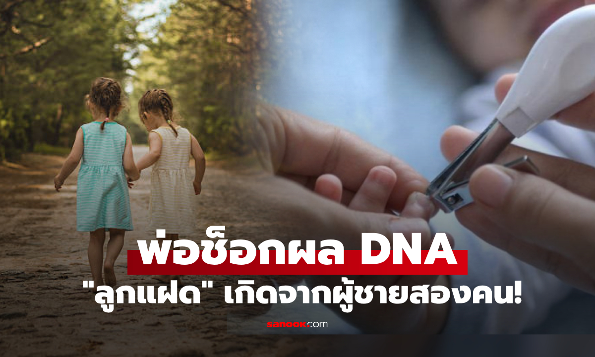 "ลูกแฝด" ยิ่งโตยิ่งต่างกัน พ่อแอบตรวจ DNA เจอความจริงสุดช็อก เกิดจากผู้ชายสองคน!