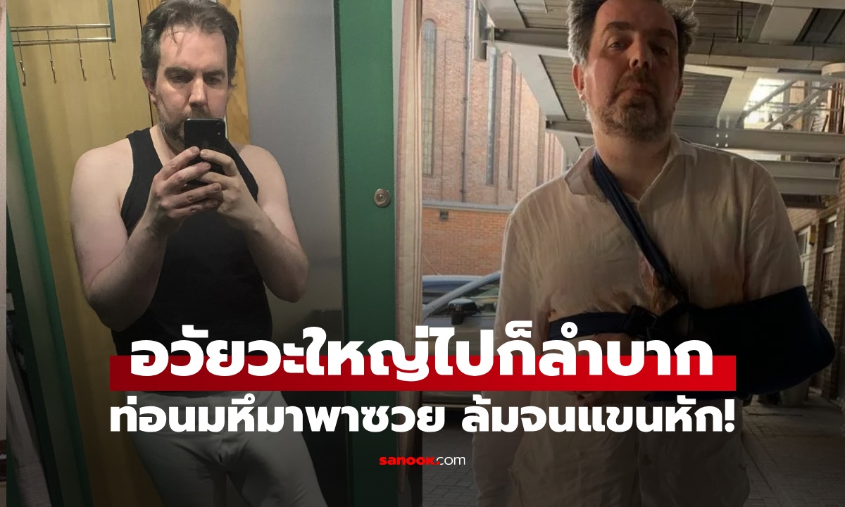 เปิดชีวิตชายเจ้าของสถิติ "อาวุธลับ" ใหญ่ที่สุดในโลก ท่อนมหึมาพาซวย ล้มจนแขนหัก!