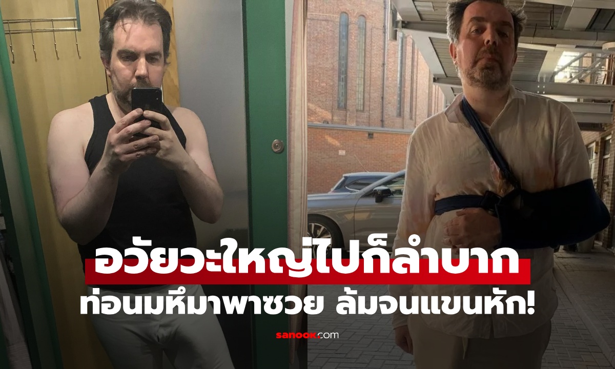 เปิดชีวิตชายเจ้าของสถิติ "อาวุธลับ" ใหญ่ที่สุดในโลก ท่อนมหึมาพาซวย ล้มจนแขนหัก!