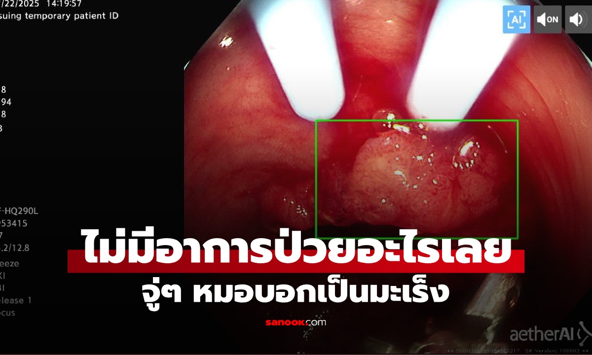 หนุ่มวัย 28 ไม่มีอาการป่วย ช็อกตรวจเจอมะเร็ง หมอเตือน 1 สิ่งสำคัญที่ทุกคน "ต้องทำ"