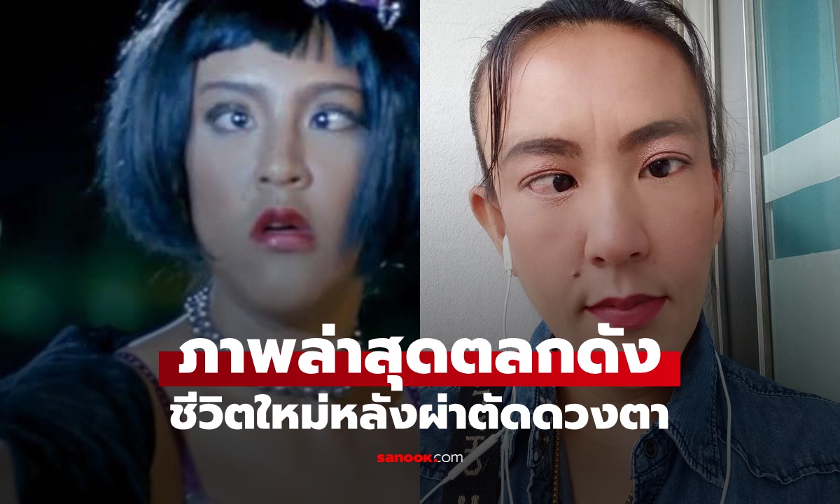 เปิดภาพล่าสุด ตลกดังในตำนาน หลังผ่าตัดดวงตา ชีวิตใหม่ที่แลกกับการไร้จุดขาย