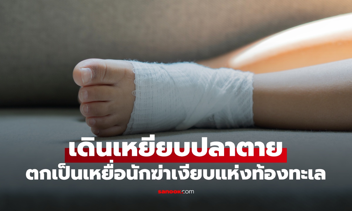 เผลอเหยียบ "ปลาตาย" เตือนภัย "นักฆ่าเงียบแห่งท้องทะเล" ป่วยหนักเกือบถูกตัดขา