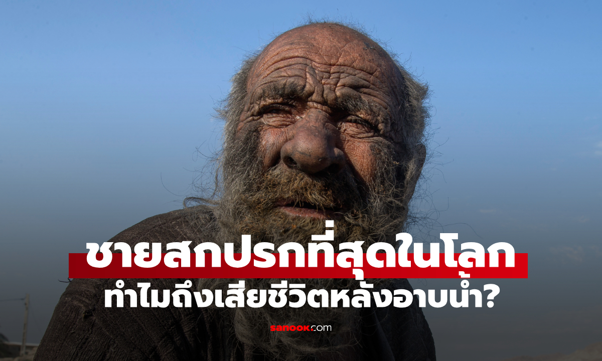 แบบนี้ก็มีด้วย โดน