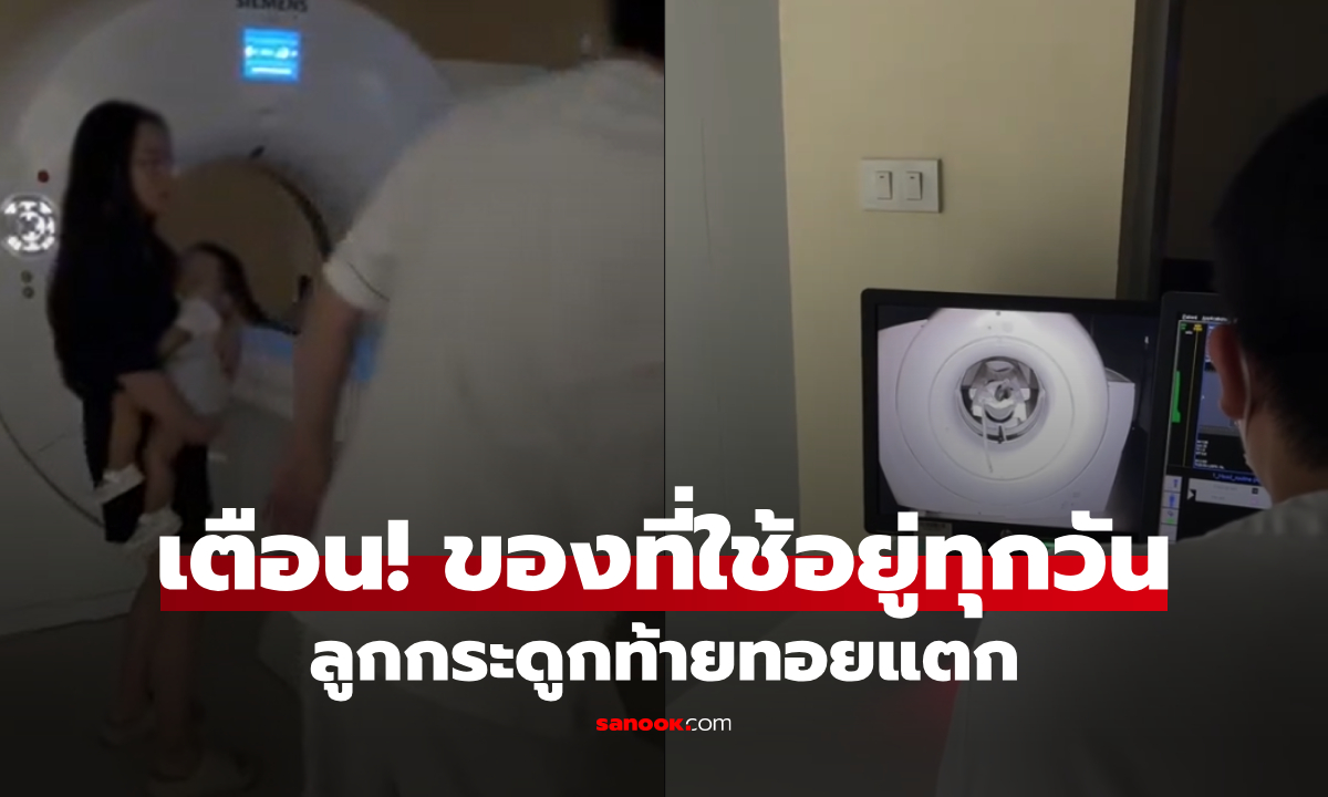 แม่ร่ำไห้เตือน ลูกกระดูกท้ายทอยแตก ช็อกซ้ำ สาเหตุมาจาก 1 สิ่งที่ใช้อยู่ทุกวัน!!!