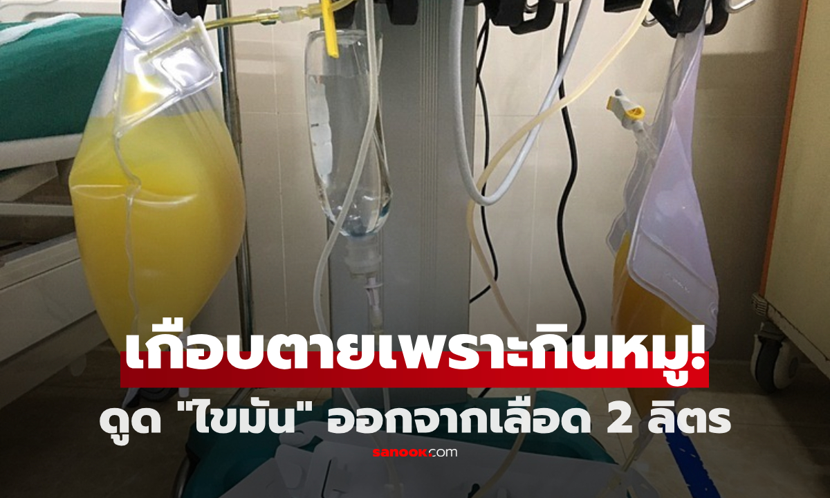 สาวเกือบตาย ถูกดูด "ไขมัน" ออกจากเลือด 2 ลิตร เพราะชอบกินหมูแบบนี้!