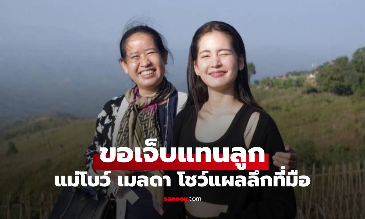 คุณแม่ขอเจ็บแทน "โบว์ เมลดา" โชว์บาดแผลลึกที่ข้อมือ ลูกสาวรีบคอมเมนต์