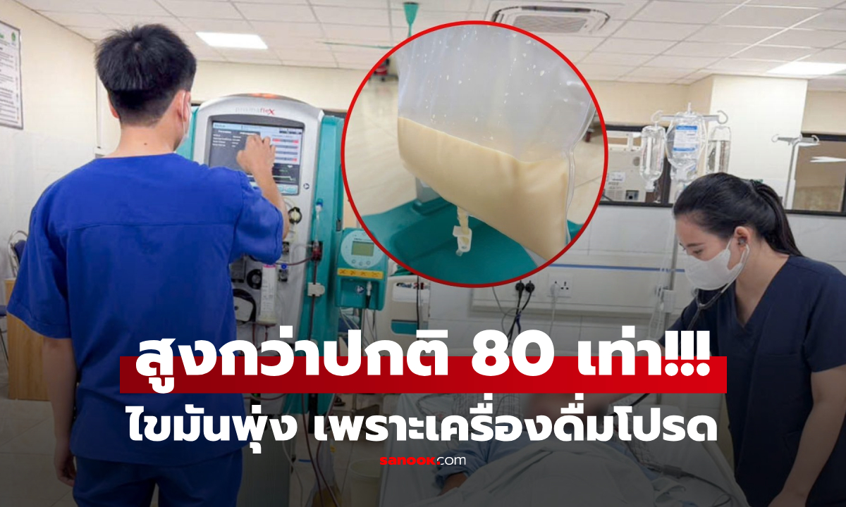 พิษเครื่องดื่มโปรด ชายไขมันในเลือดพุ่ง "สูงกว่าปกติ 80 เท่า" รู้ไม่ดี แต่หลายคนเลิกไม่ได้!