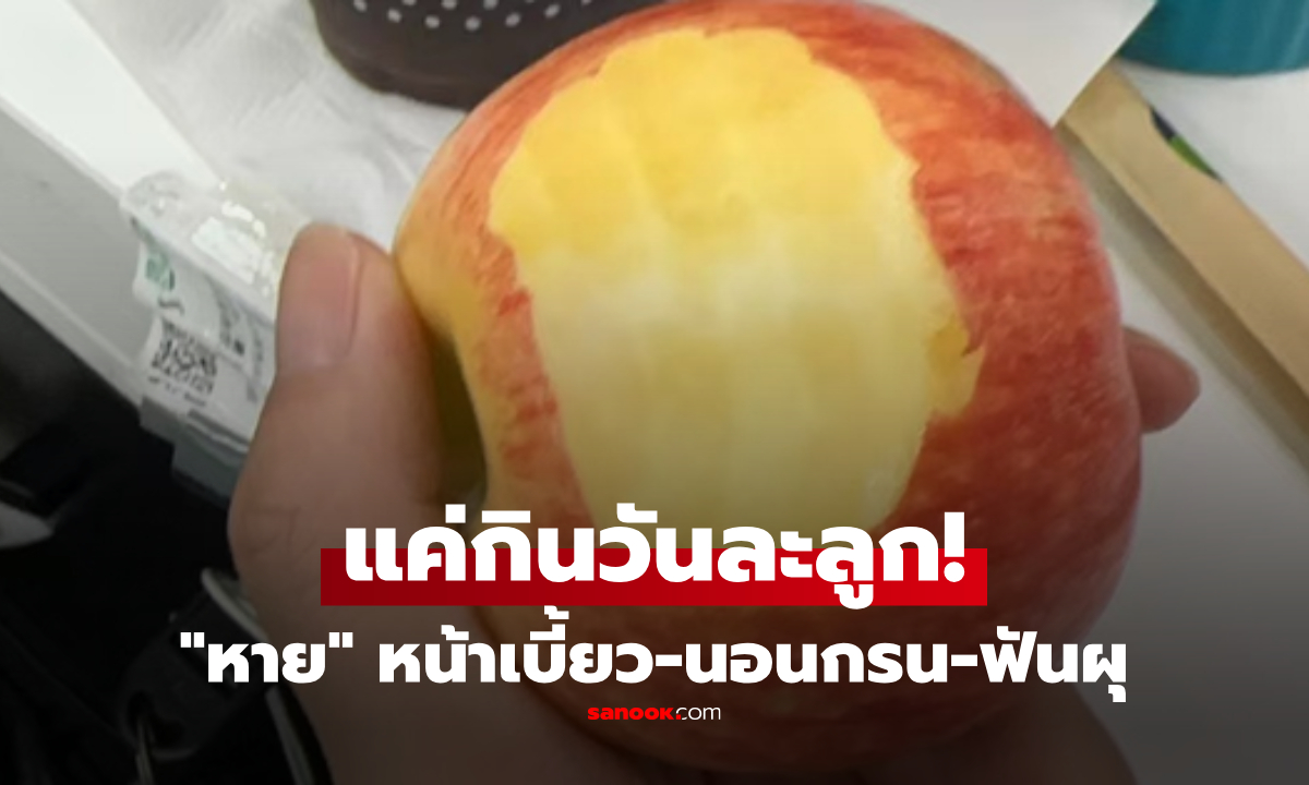 หมอแชร์เคสทึ่ง แค่กิน "แอปเปิล" วันละลูก เด็กเคยหน้าเบี้ยว-นอนกรน-ฟันผุ หายเป็นปกติ!