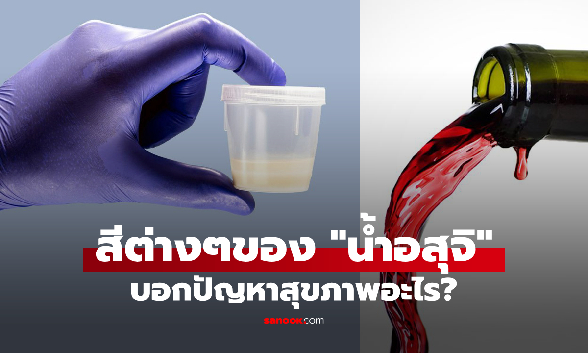 สีของ "น้ำอสุจิ" บอกปัญหาสุขภาพอะไรของเราได้บ้าง?