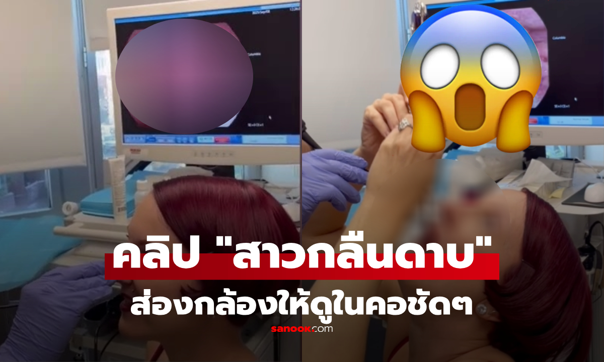 สุดช็อก! สาวกลืนดาบยาว 46 ซม. พิสูจน์ชัดๆ ด้วยคลิปส่องกล้อง "ภายในคอ"