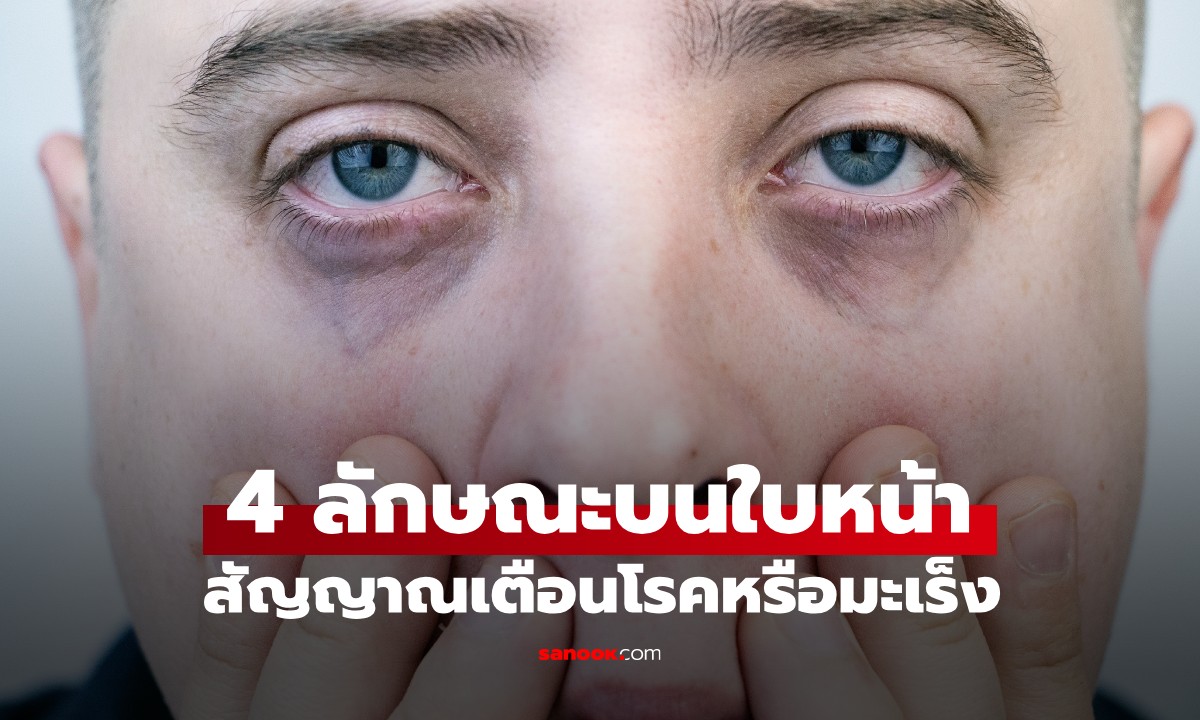 4 ลักษณะบนใบหน้า สัญญาณเตือนโรคหรือมะเร็ง อย่าสับสนกับ "โหงวเฮ้งนำโชค"