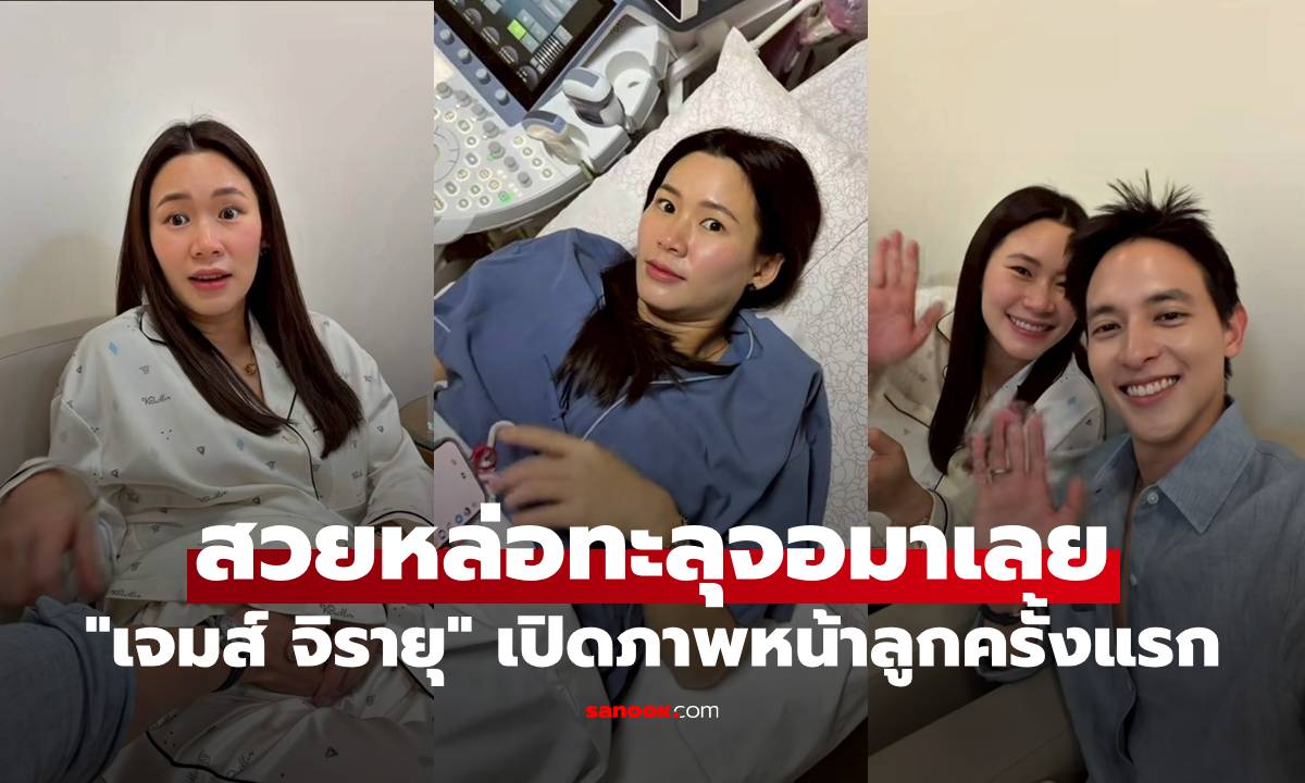 "เจมส์ จิรายุ" เปิดภาพหน้าลูกครั้งแรก ความสวยหล่อทะลุจอมาเลย