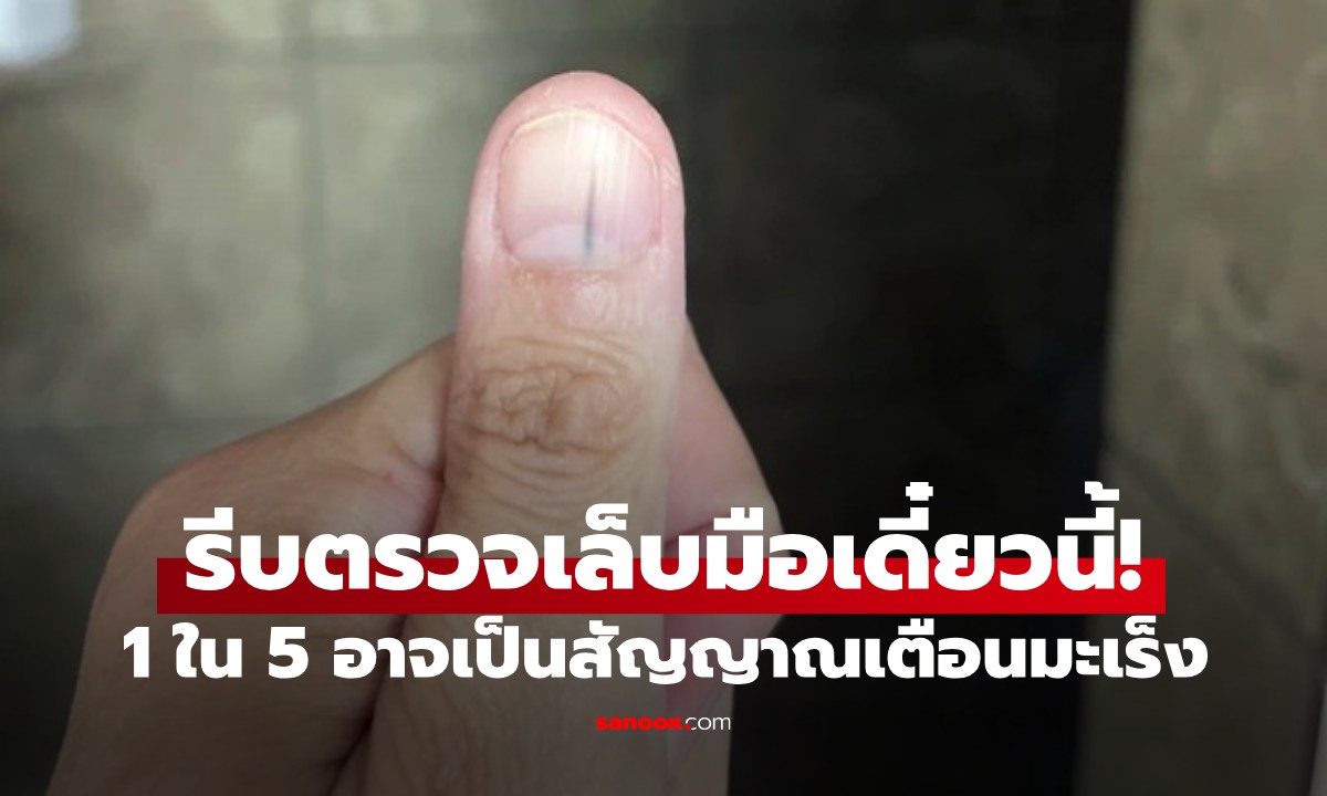 5 สัญญาณมะเร็งร้าย ที่ "เล็บมือ" ส่งสัญญาณเตือน แต่หลายคนมองข้ามเพราะไม่รู้!