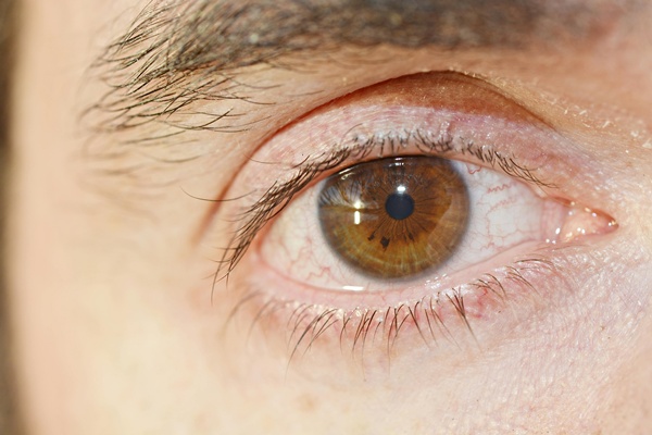 ภาพประกอบข่าว