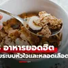 8 อาหารยอดฮิต ที่แอบ "ทำลาย" หลอดเลือด หมอบอกตรงๆ "ถึงให้เงินก็ไม่กิน!"