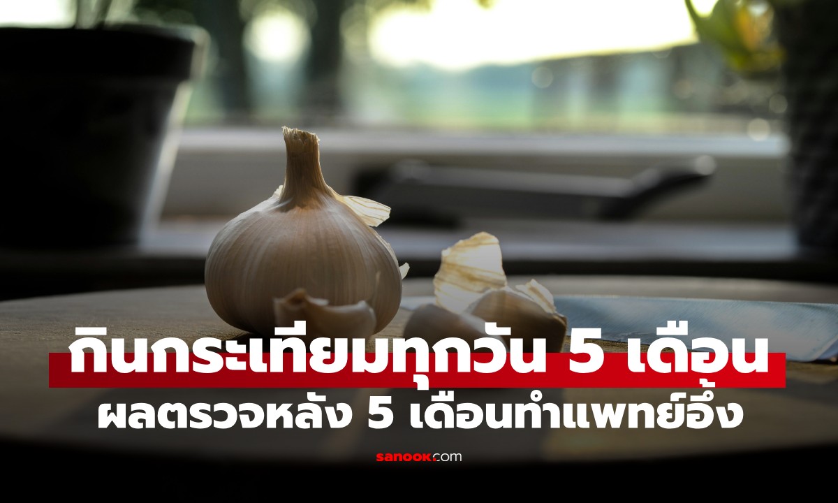 ชายวัย 28 ไตอักเสบ กินกระเทียมทุกวัน 5 เดือน หมอต้องตรวจซ้ำอีกครั้งด้วยความตกตะลึง