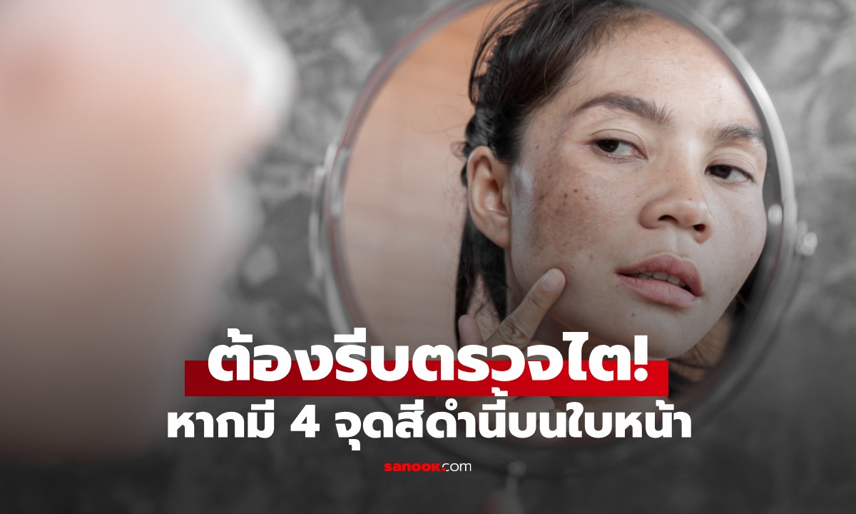 หากมี 4 จุดสีดำนี้บนใบหน้า ต้องรีบตรวจไต! สัญญาณร้ายแรงที่สุดอาจเป็น "มะเร็ง"