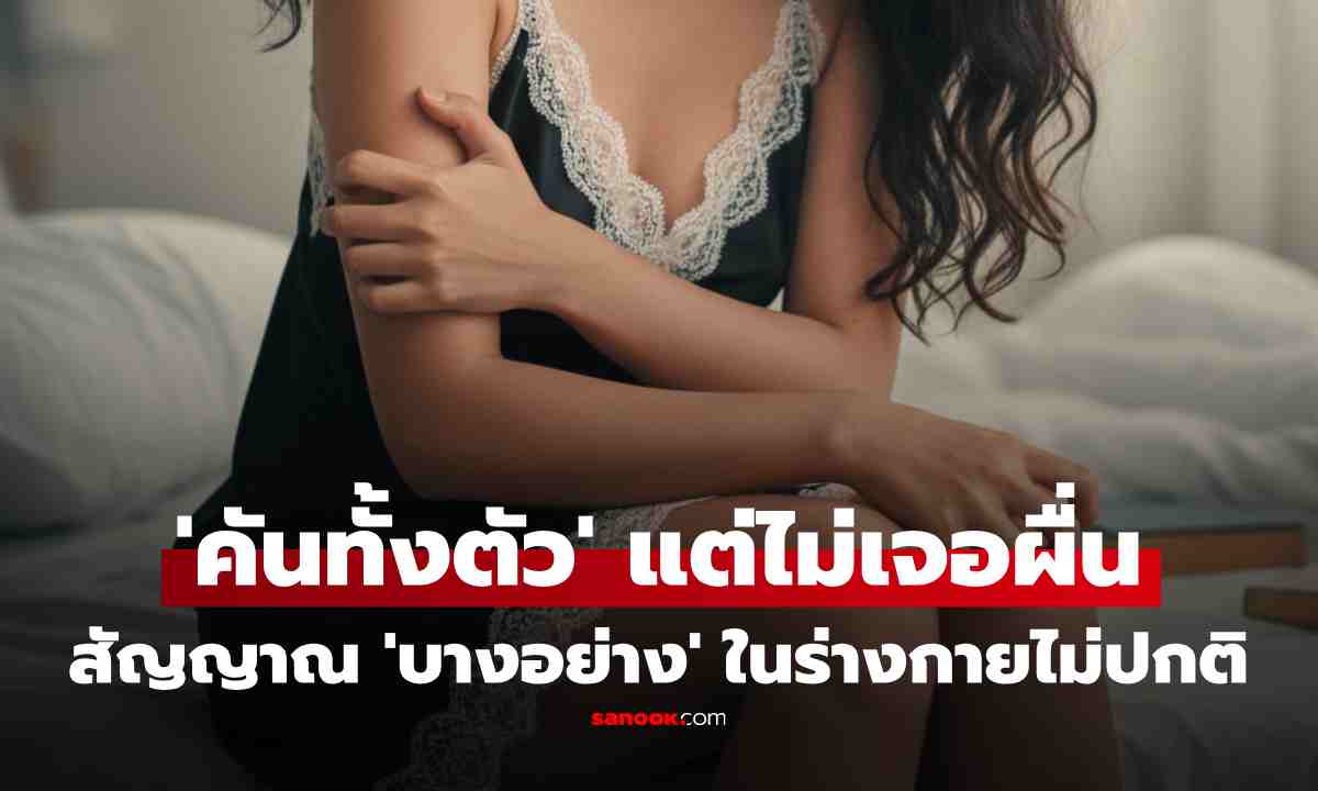 อาจไม่ใช่แค่ผิวแห้ง! หมอเตือน "คันทั้งตัว" แต่ไม่มีผื่น สัญญาณผิดปกติจากภายในที่คนมักมองข้าม